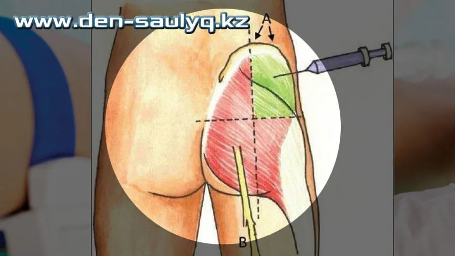 Акупунктура (ине терапиясы) Акупунктура (ине терапиясы)