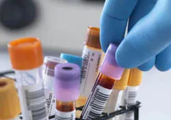 Қандағы қант деңгейін анықтау Қандағы қант деңгейін анықтау